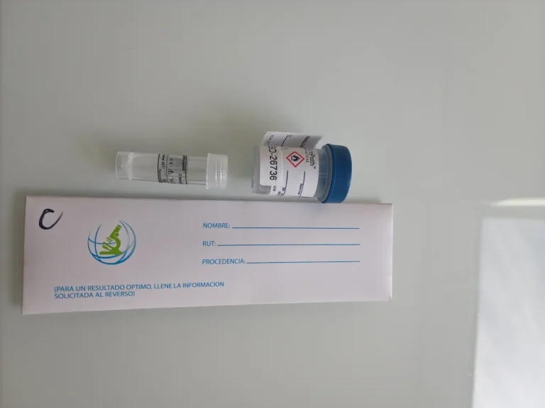 Tubo de transporte, frasco de muestra y formulario de laboratorio para exámenes PCR en MarianaCentro, Providencia