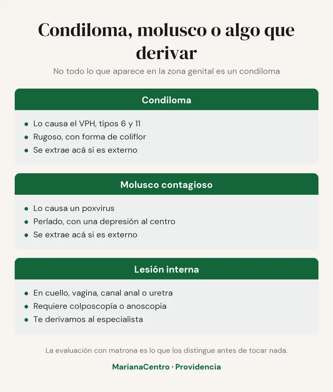 Condiloma, molusco contagioso o lesión interna: cómo se distinguen. El condiloma lo causa el VPH 6 y 11 y es rugoso; el molusco contagioso lo causa un poxvirus y es perlado con una depresión al centro; la lesión interna requiere derivación.