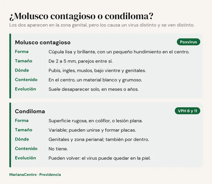 Diagrama comparativo: molusco contagioso (poxvirus) y condiloma (VPH 6 y 11) según forma, tamaño, ubicación, contenido y evolución