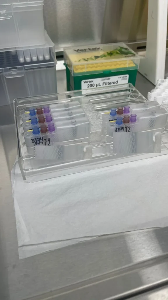Muestras de PCR para exámenes de ITS en un rack del laboratorio de MarianaCentro