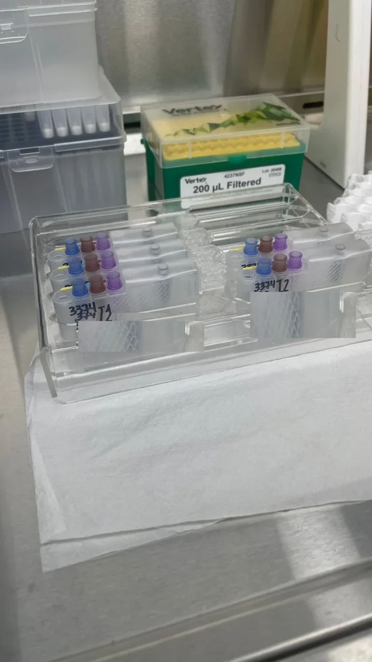 Muestras de PCR para exámenes de ITS en un rack del laboratorio de MarianaCentro